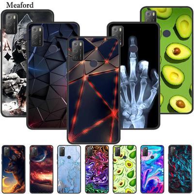 For Alcatel 1S 2021 Case Luxury Silicone TPU Soft Cover Phone Case for Alcatel 1S 2020 Shockproof Cute TPU Bumper Fundas Coque