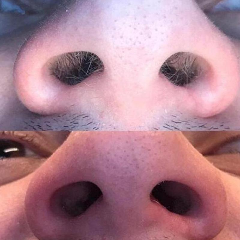 Nose Hair Wax Kit Effective And Safe Nose Hair Removal Women For Men And Set