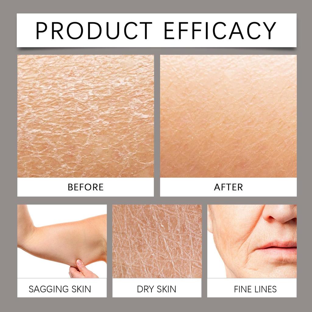 XIMONTH Body Care Magnesium Cream Gentle Nourishing Moisturizing After Sport Care Refreshing Skin Care Body Lotion