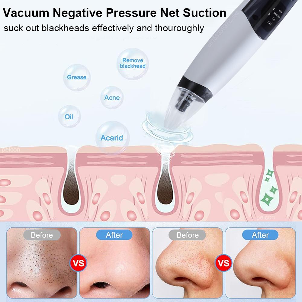 Blackhead Remover Pore Cleaner Black Dots Remover Electric Black Point Extractor Pimple Acne Blackhead Black Dots Vacuum Cleaner