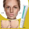 Powerful Spot-removing Whiten Cream Brighten Skin Fast Eliminates Melanin Pigmentation Melasma Dark Spots Moisturize Beauty Gel