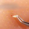 Pimple Popping Toy,Nose Shape,Relaxing Toy with Tweezer Lightweight Remover Funny Fidget for Gag