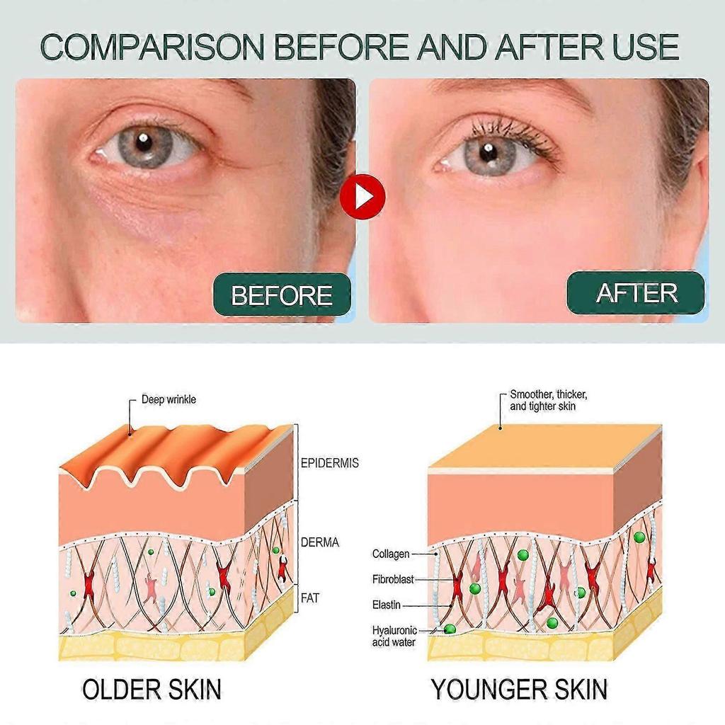 30ml Anti-Aging Daily Serum with Matrixyl 3000, Vitamin C & Hyaluronic Acid - Firms Skin, Brightens Tone, Hydrates for Radiant Complexion