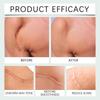 Silicone Scar Patch Skin Repair Sheets Removal Self-Adhesive Stretch Mark Tape Therapy Patch For C-Section Burn Acne Scar