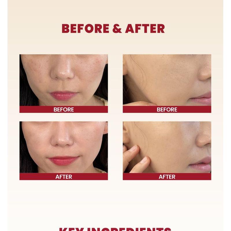 KSECRET - SEOUL 1988 Cream : Snail Mucin 93% + Rice