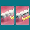 10 Stück Interdentalbürsten Kieferorthopädischer Stahl Draht Zahnbürste Push-Pull Bürste Entfernt Speisereste Aufhellender Reiniger Mundhygiene Werkzeug