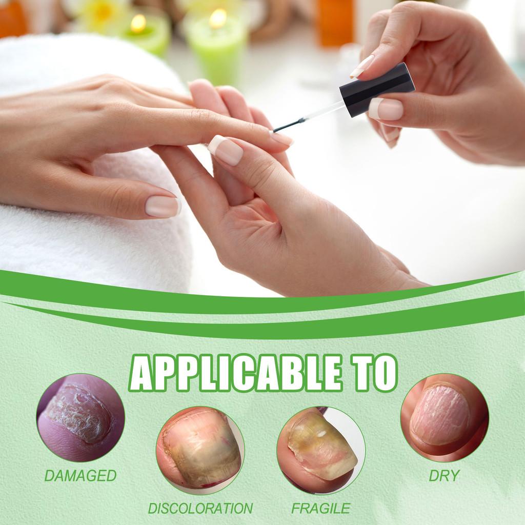 South Moon Nail Care Solution With Tea Tree Oil And Vitamin E For Healthier Nails