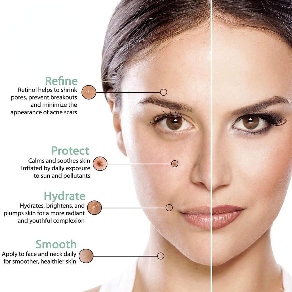 Anti Aging Face Cream, Rich In Collagen, Prevents Dry Lines, Moisturizes And Moisturizes