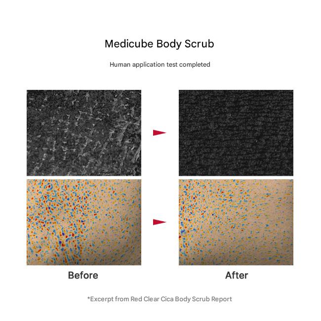 Medicube Red Clear Cica Body Scrub 270g (3 Options)