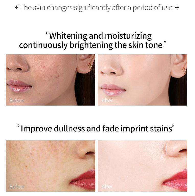 Anti-wrinkle Sleeping Hydrating Moisturizers Smoothing Moisturizing Firming Anti Aging Skin Face Cream Whitening Spot Removing Cream