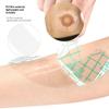 10Pcs Hydrocolloid Adhesive Seal Extender Strip Ostomy Barrier Strip Colostomy Bags Curved Ileostomy Tape For Stoma Urostomy Bag