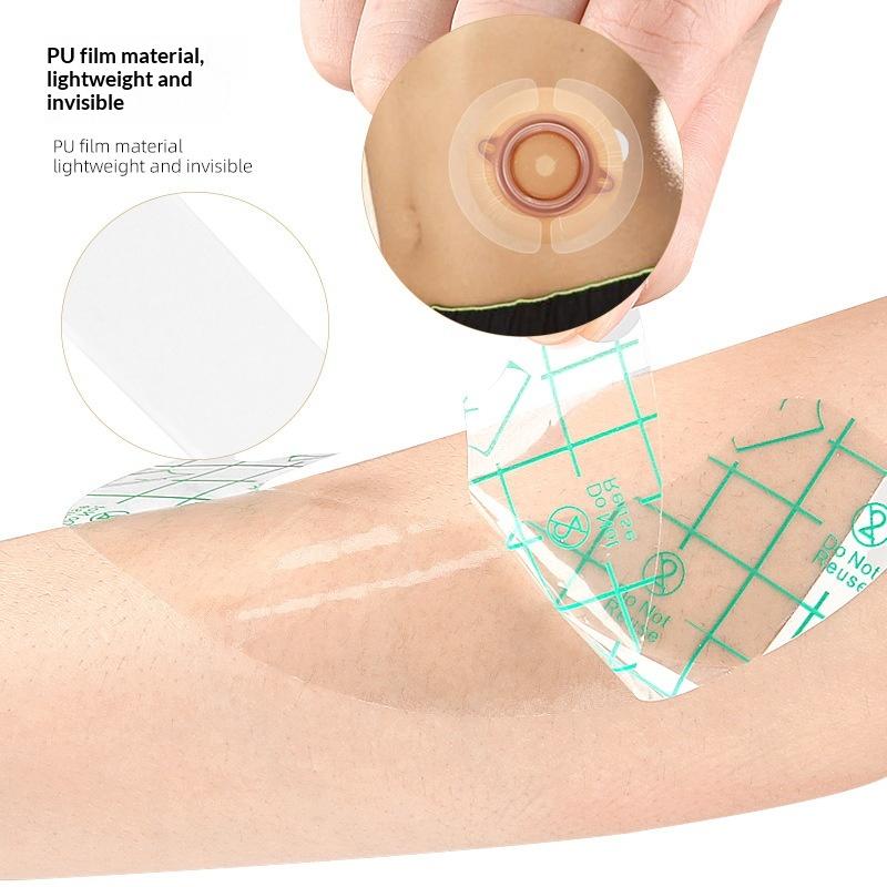 10Pcs Hydrocolloid Adhesive Seal Extender Strip Ostomy Barrier Strip Colostomy Bags Curved Ileostomy Tape For Stoma Urostomy Bag