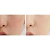Merge the First Creamy Concealer 5.6g, CL1 Apricot, 2 ea.
