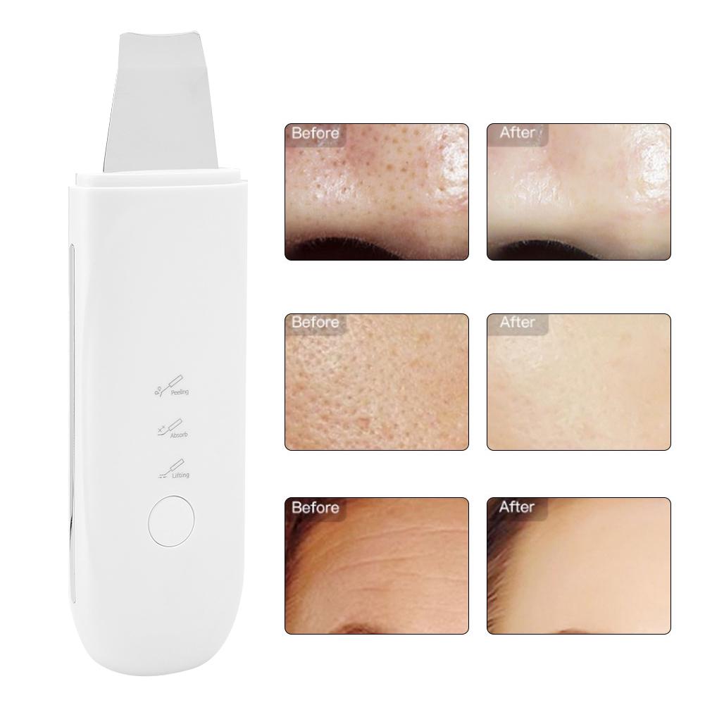 Ultrasonic Skin Scrubber Acne Blackhead Removal Face Pore Cleaning Skin Rejuvenation Machine