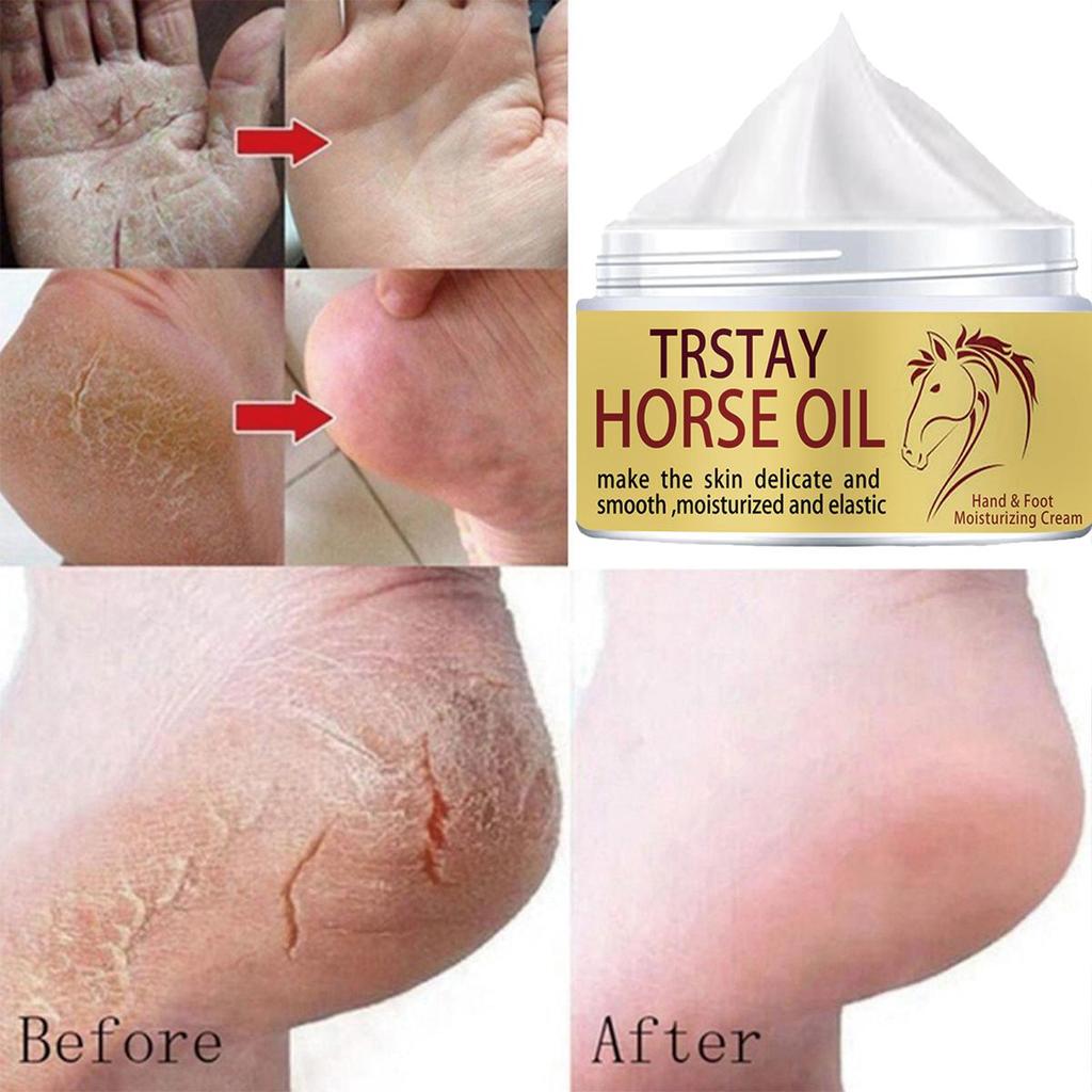 Fotpleiekrem for tørre og sprukne hæler, fotfuktighetskrem for reparasjon av sprukne hender, føtter og hud