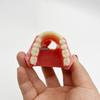 Modello Didattico Dentale: Arcata edentula con protesi rimovibile e 2 impianti