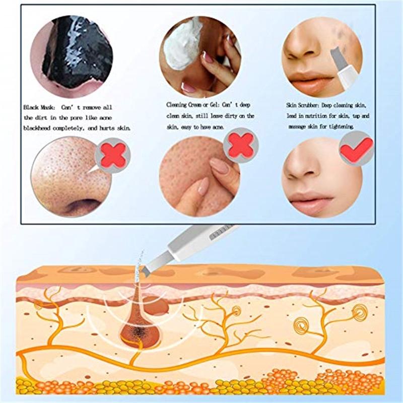 Ultrasound Skin Care Scrubber Pore Deep Cleansing Facial Face Ultrasonic Lifting Tool