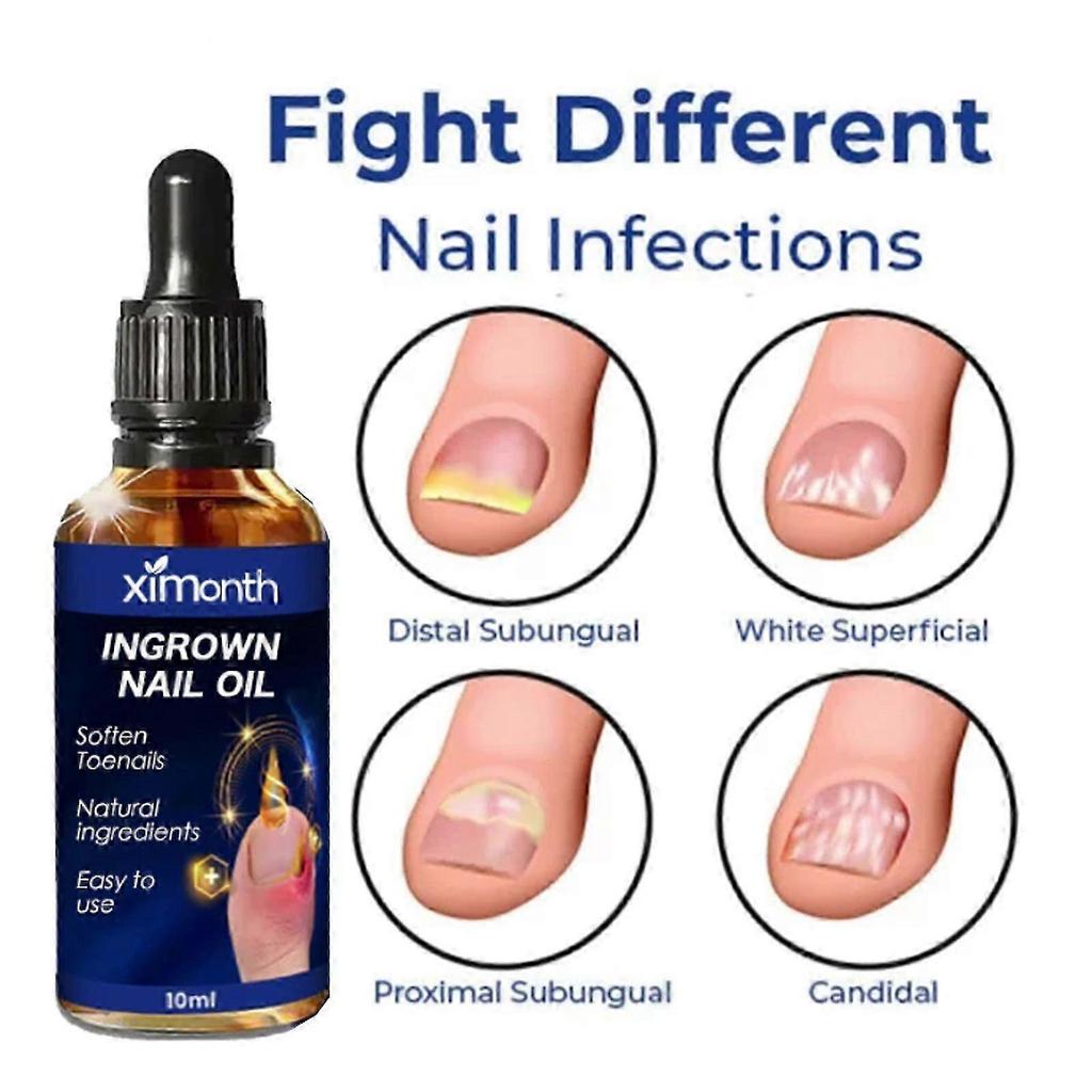 Ingrown Nail Oil