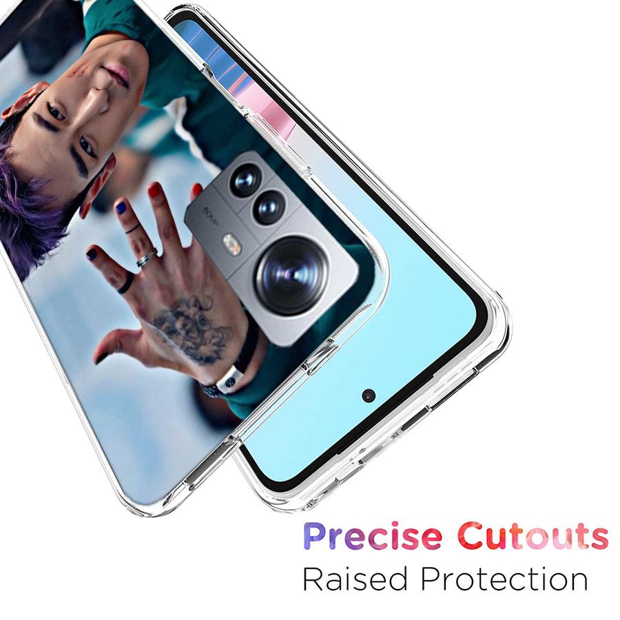 C-Choi S-Seung Hyun T-TOP Handyhülle Für Xiaomi 15 Poco X7 X6 F7 14 Ultra Mi F6 F5 F4 F3 X5 X4 X3 M6 Pro M5 M5S M3 Capa Coque