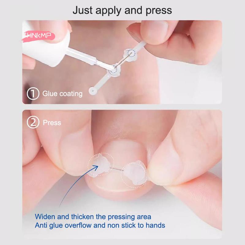 Ingrown Toenail Correction Tool with Elastic Patch Sticker Straightening Clip Brace - Toe Nail Treatment Pedicure Solution