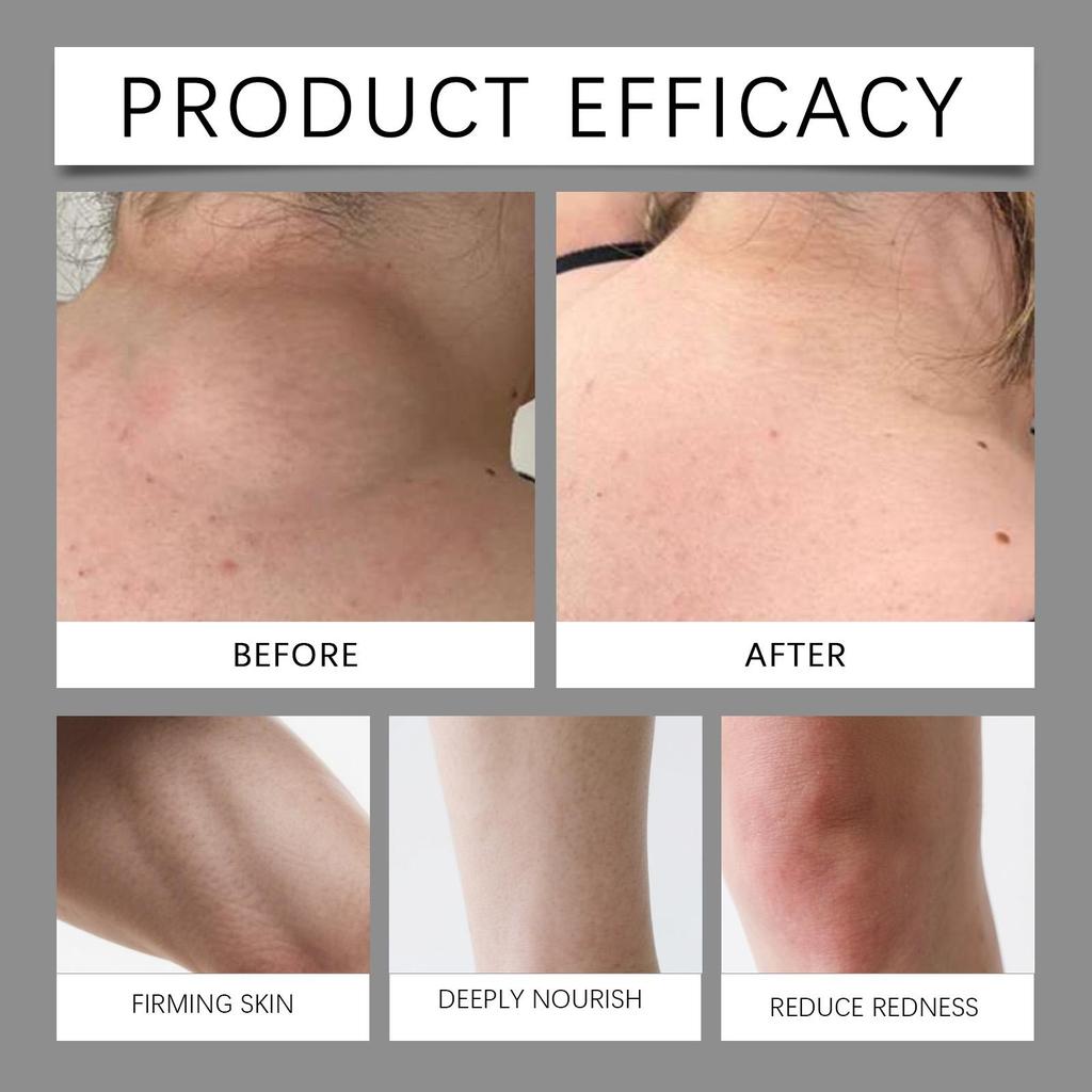 Schwarzer Reis Nährende Creme Reparierend Beruhigend für Empfindliche Haut Tiefe Hydratation Feuchtigkeitsspendend Barriereerneuerung Sanfte Formel