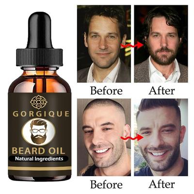 Beard Growth Liquid Hair Growth Agent Promotes Thicker and Longer Beard Growth, Moisturizing and Moisturizing Beard Care Liquid Hair Growth Liquid