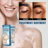 Natural Vitiligo Treatment Cream for Even Skin Tone and White Spot Reduction