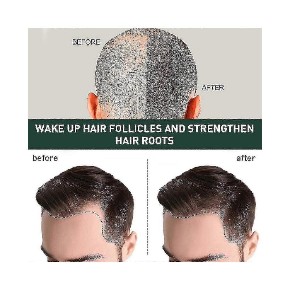 7days Hair Growing Serum, Anti-detachment,hair Development30ml