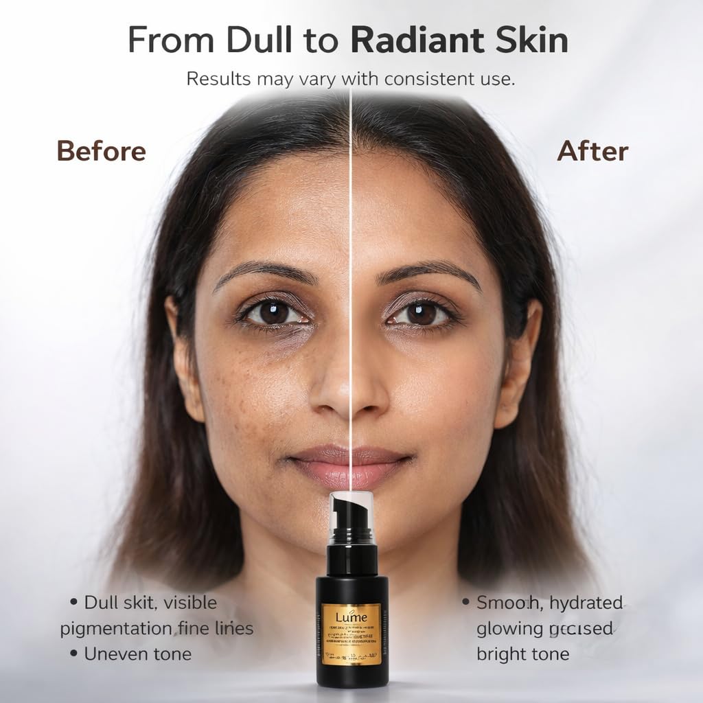 Lumea Anti Aging Face Serum for Wrinkles, Fine Lines, Dark Spots & Pigmentation Removal | Retinol, Hyaluronic Acid, Vitamin C, E & Rosehip Extract