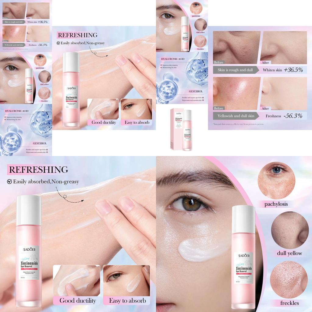 Sadoer Niacinamid Hautaufhellende Reparatur-Lotion für strahlende Haut und Fleckenbehandlung