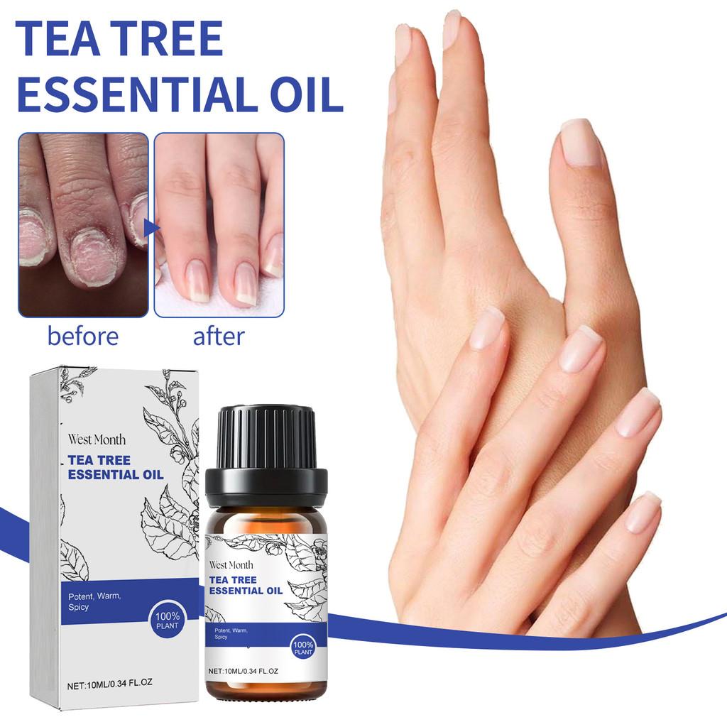 Premium Tea Tree Essential Oil 10ml For Nourishing Skin And Strengthening Nails