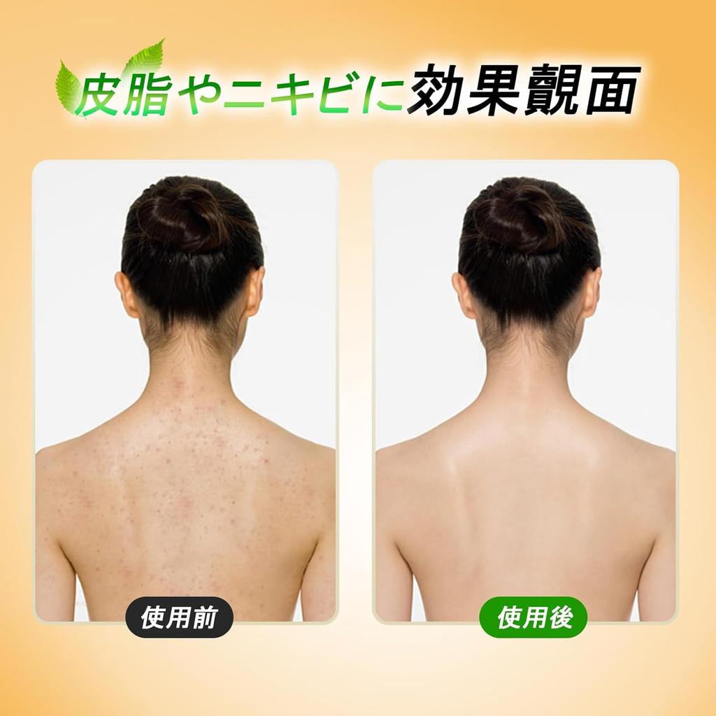 Savon Soufré Visage Savon Soufré Shanghai Contrôle du Sébum Adoucissant Pores Obstrués Barre de Savon Sûre Faible Irritation Pour Peau Mixte 130g Blanchissant