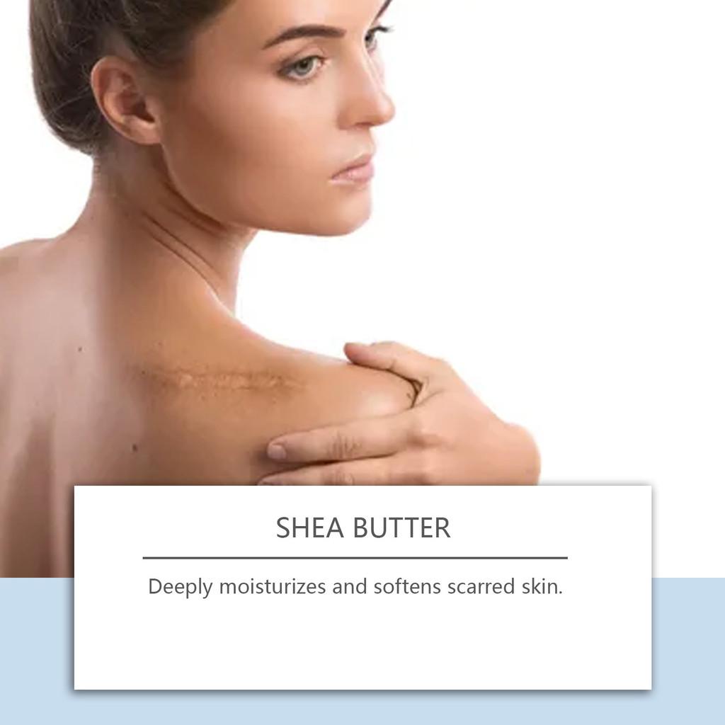 Houkea Skin Repair Cream Gentle Moisturizing Hydrating Smooth Skin Balm 15g