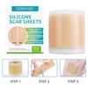 Silicone Gel Scar Patch: 1.5m Self-Adhesive, Waterproof, Sweatproof, Neutral Packaging