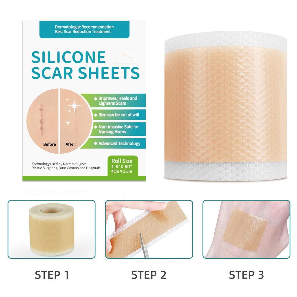 Silicone Gel Scar Patch: 1.5m Self-Adhesive, Waterproof, Sweatproof, Neutral Packaging