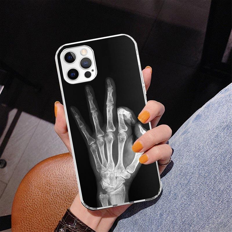 Autumu X Ray Hand Bones Phnoe Case for Iphone 17 Air 16 16E 11 12 13 Mini 14 Plus 15 Pro Max 7 8 + SE 2020 Phone Cover Coque
