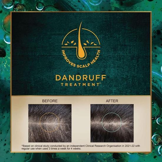 Indulekha Svetakutuja Dandruff Treatment Scalp Serum 30ml |Ayurvedic serum for dandruff treatment