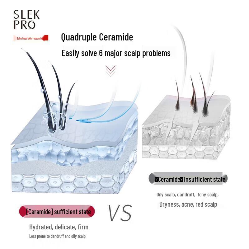 Surlast Moisturizing Anti-Dandruff Shampoo