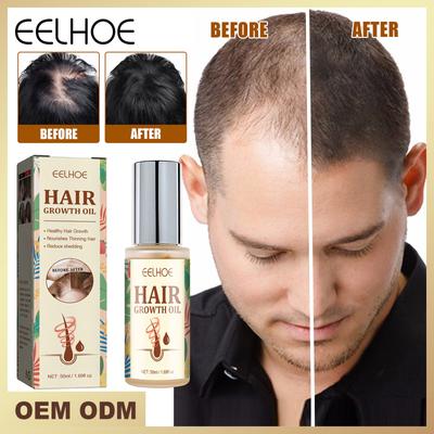 Rosmarin Haarpflege Ätherisches Öl Anti-Frizz Haarwachstum Glattes Serum Haaröl Anti Haarausfall Neue Behandlungen Haarschönheit