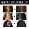Hair Growth Serum, Jaysuing: Prevents Hair Loss, Nourishes Dry and Damaged Hair, Promotes Natural Hair Growth, and Prevents Hair Loss