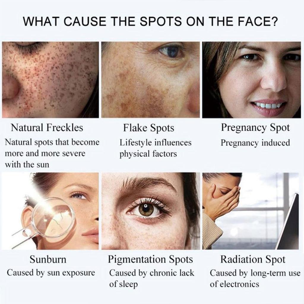 Brightening and Freckle Cream Brightening Skin Tone Lightening Spot Hydrating Moisturizing Cream Nourishing Serum