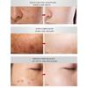 Whitening Cream  Fade Spots Blackheads Melanin Moisturizing Brightening Soft Smooth Firming Skin Care