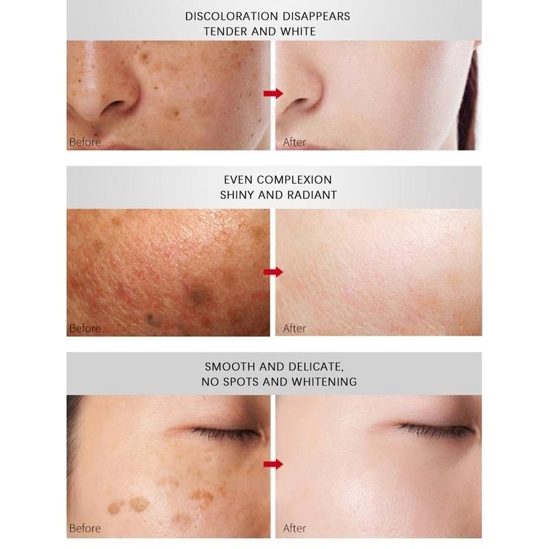 Whitening Cream  Fade Spots Blackheads Melanin Moisturizing Brightening Soft Smooth Firming Skin Care