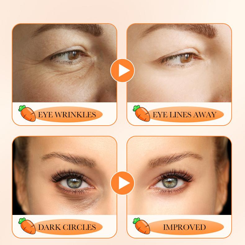 Bio-Karotten-Augencreme gegen Augenringe und Falten – Feuchtigkeitsspendende Formel von SADOER