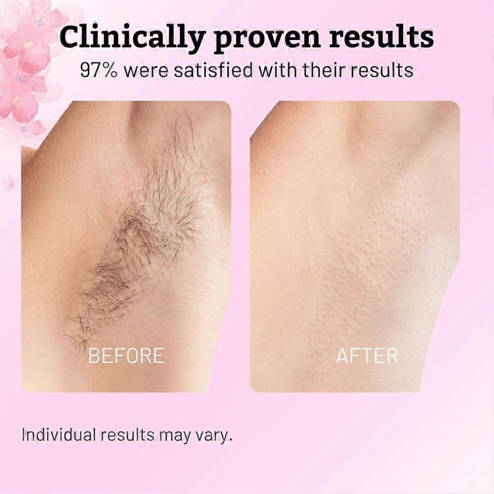 (2pcs)Natural Cyperus Rotundus Oil For Hair Removal, Moisturizing & Soothing Cyperus Rotundus Oil For Reducing Body Hair, Deep Nourishment
