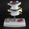 Anatomical Lumbar Disc Herniation Demonstration Model Human Spine School Training Supplies