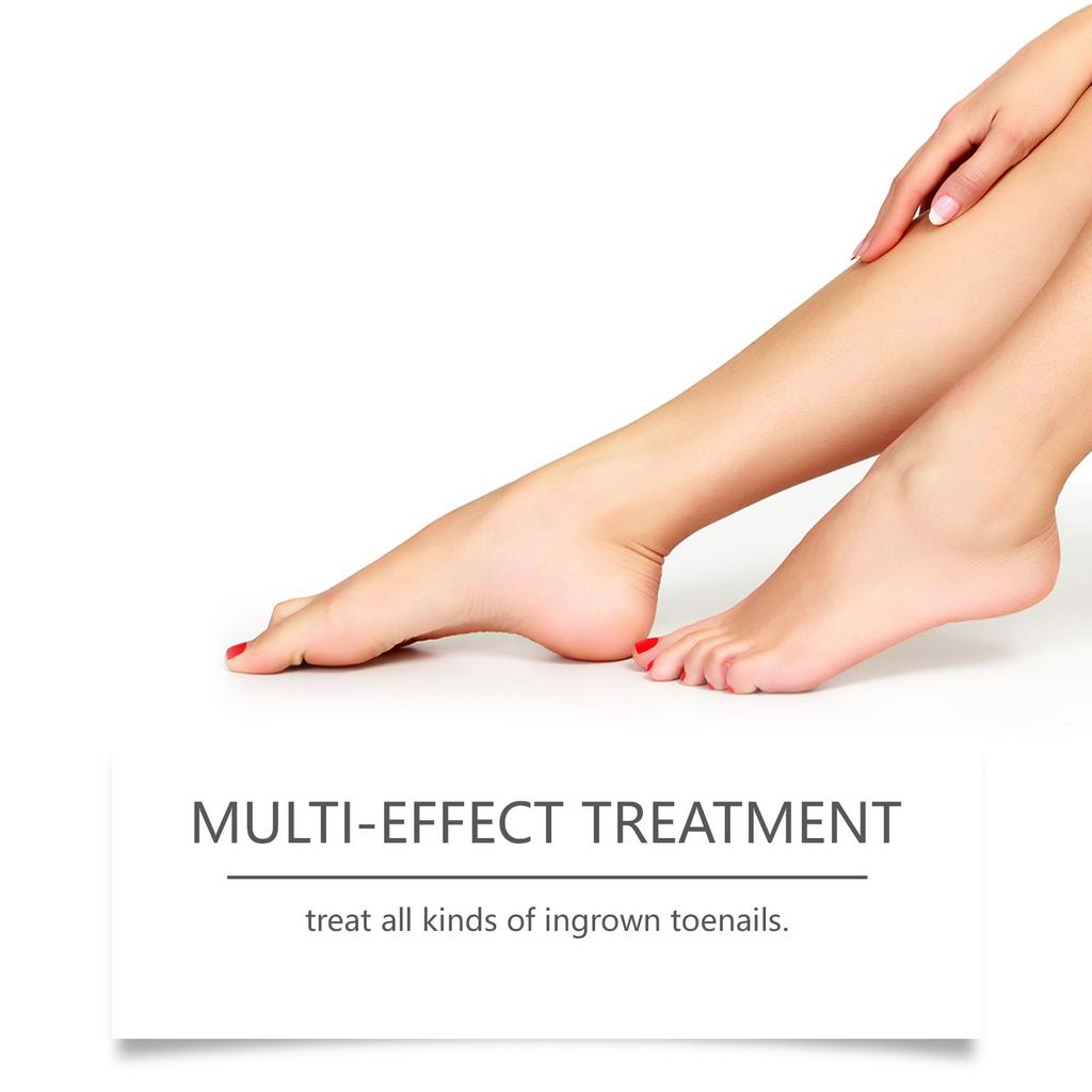 Breathable Curved Toenail Corrector Set; Toenail Correction Stickers; Nail Care