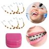 2Pcs Colored Dental Decor Braces with Storage Box Orthodontic Metal Wires Bracket Cartoon Pattern for Daily Tooth Protect