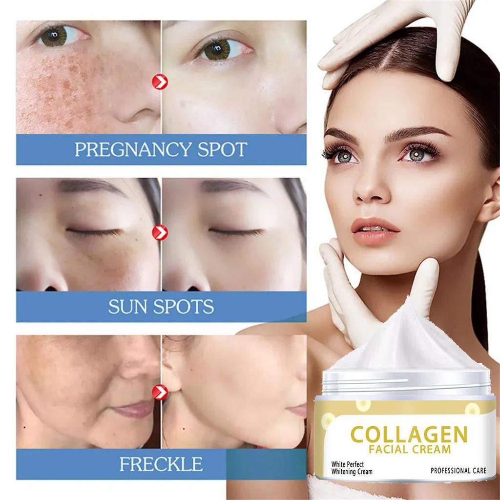 Whitening Moisturizer, Brightens Skin Tone, Moisturizes, Lightens Dullness, Tightens Skin