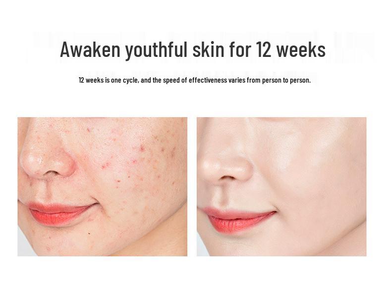 Ultrasonic Ion Face Massager with Hot/Cold Therapy & Light Rejuvenation